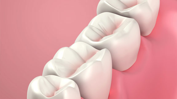 Bone Graft