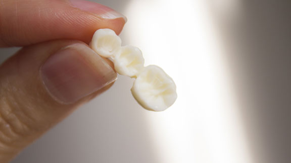 Bone Graft