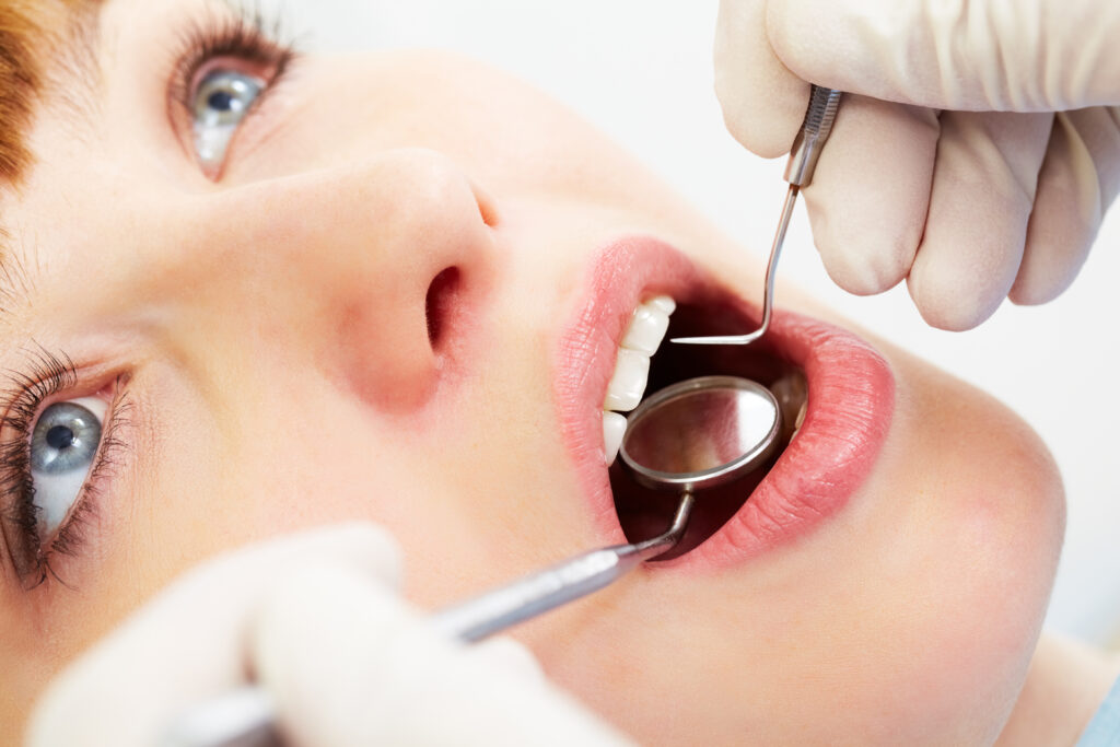 An image of a dental patient getting treated for Scaling And Root Planing Procedures.